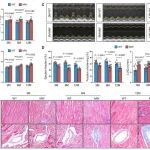 Science子刊 | 山东大学陈玉国等团队发现PIEZO1功能获得突变通过破坏心肌脂质稳态和铁超载驱动心肌病