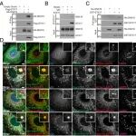 PNAS | 华中科技大学荣岳光团队发现mTORC1通过SNX16磷酸化调节自噬体成分循环