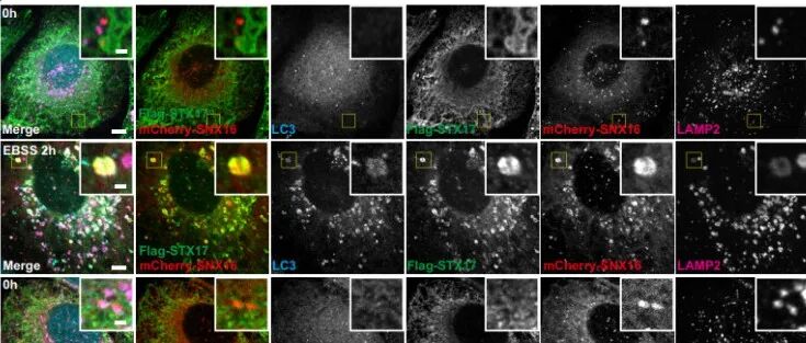 PNAS | 华中科技大学荣岳光团队发现mTORC1通过SNX16磷酸化调节自噬体成分循环