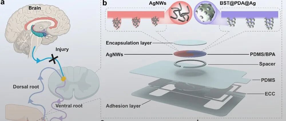 华中科技大学吴豪教授 AFM：多模态表皮传感器驱动的痉挛等级客观评估
