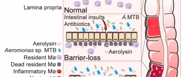 Science｜南京大学朱敏生教授团队在溃疡性结肠炎（UC）的病因研究上取得重大突破