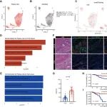 eBiomedicine | 杜峻峰团队及合作者揭示成熟三级淋巴结构是直肠癌抗肿瘤体液免疫的核心枢纽