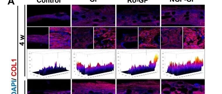 山东第二医科大学《CEJ》：多功能NGF-PLGA微球-PCLGelMA支架促进骨-血管-神经的协调再生