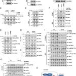 Cell Chem. Biol. | mTOR乳酰化促进运动时骨骼肌的自噬过程