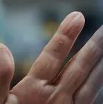 为什么手指泡水会变皱？