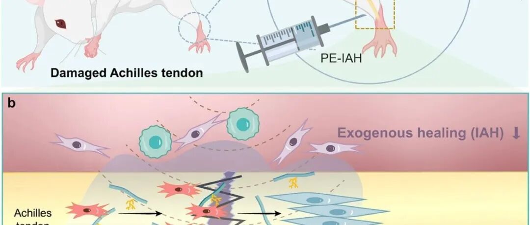 文献分享 | Adv. Mater. | 用于促进肌腱损伤内源性愈合的压电注射型防粘连水凝胶
