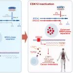 Cancer Res | 浙江大学研究团队发现CDK12缺陷型癌症的潜在新靶点