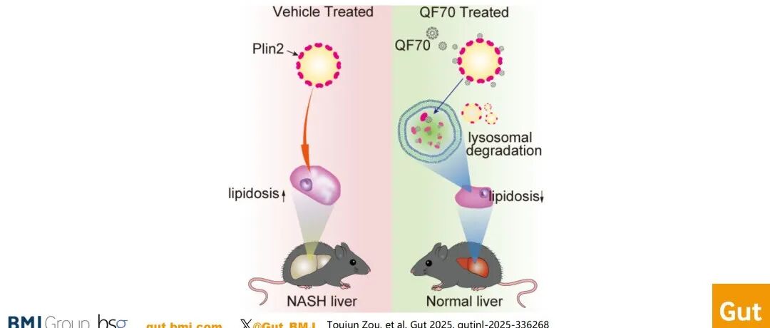 李红良团队最新Gut