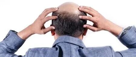 一次压力，可能导致反复脱发！《细胞》揭秘压力如何“种下祸根”