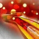 无症状颈动脉重度狭窄，吃药就行，还是手术？NEJM发表新证据