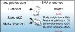 Bone Res | 苏州大学周晓中等团队发现SMN缺乏抑制软骨内成骨的调控新机制
