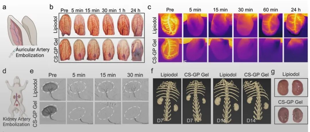 苏州大学冯良珠教授、刘庄教授团队 AFM：温敏催化水凝胶助力酶触“破膜+氧化应激”级联肿瘤消融新策略