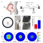 Science Advances：智能、紧凑型可穿戴压力应变组合传感器系统，用于连续胎动监测