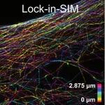 Nat. Commun. | 从亚细胞到亚细胞器：开源锁相去背景结构光照明超分辨成像