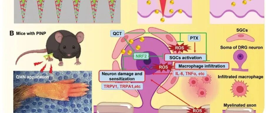 《Small》： HA-PBA-QCT双层微针贴片用于治疗紫杉醇引起的周围神经性疼痛