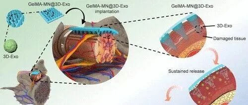 如何选择载体负载外泌体？GelMA助您一臂之力