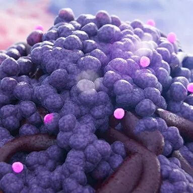 每年致180万人死亡，这种百年前的“罕见”癌症，正迎来救命新疗法