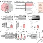 Circulation | 南京医科大学季勇等合作揭示促进心肌纤维化的新作用及分子机制