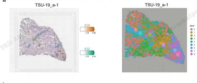 韩国国立癌症中心发现成纤维细胞驱动的TGF-β富集生态型介导ICB耐药