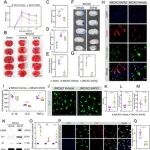 Adv Sci | 华中科技大学胡波等团队发现小胶质Fkbp5损害中风后血管完整性和再生的调控机制
