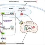 Adv  Sci | 郑州大学吴缅等团队揭示ACSL5调控谷氨酰胺缺乏症下结直肠癌细胞的葡萄糖代谢和化疗敏感性