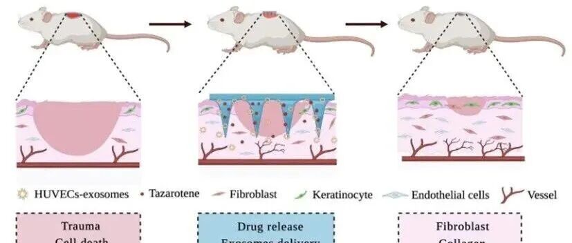 如何评价所制备微针的性能优劣？有哪些检测手段？