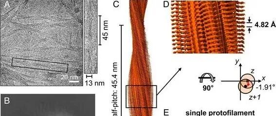 PNAS ┃ 还原半胱氨酸残基在 SOD1 淀粉样纤维形成中的结构机制研究