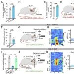 PNAS | 中国科学技术大学张智等团队发现半乳糖凝集素相关蛋白是导致糖尿病相关神经性疼痛的关键因素
