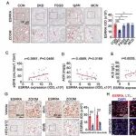 Autophagy | 武汉大学梁伟等团队发现减轻糖尿病肾病的潜在新策略