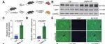 Autophagy | 电子科技大学张琳等团队合作发现驱动代谢性肝病和肝细胞癌的调控新机制