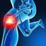 膝关节炎治疗新突破？直击“病根”，《自然》子刊发表疫苗早期临床试验结果