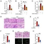 PNAS | 苏州大学温振科团队揭示狼疮性肾炎中肾小球内皮细胞清除烟酰胺腺嘌呤二核苷酸以调控CD103+ T细胞