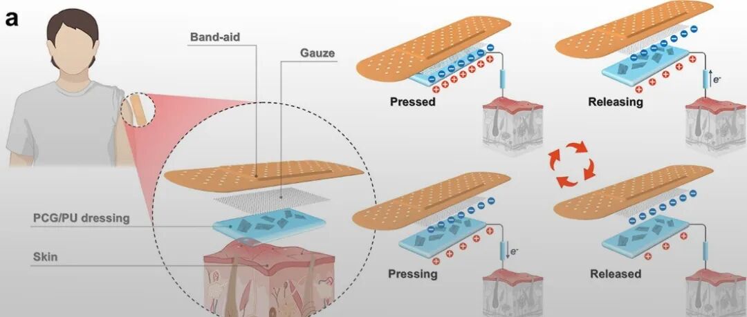 四川大学杨伟教授/尹波教授团队 ACS Nano：用于压疮的泄压、监测与治疗的自供能凝胶贴片
