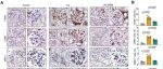 Adv Sci | 中山大学刘庆华等团队揭示硒纳米颗粒激活通过GPX1重新编程M2b巨噬细胞，减毒狼疮肾炎