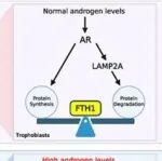 Adv Sci | 浙江大学张银丽等发现高雄激素血症诱发多囊卵巢综合征患者的营养层细胞铁凋亡和早孕流产的潜在机理