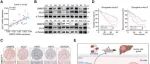 Adv Sci | 复旦大学史颖弘等团队合作发现仑伐替尼治疗肝细胞癌产生耐药性的新机理