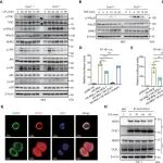 Science子刊 | 细菌入侵后身体怎么‘开闸’抗炎症？——肖武汉团队发现OCEL1被降解释放NF-κB信号启动免疫防御