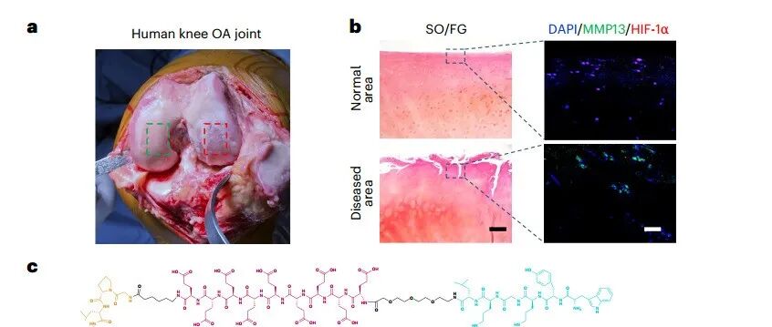 背靠背两篇Nature大子刊，陈小元等团队合作在胶质母细胞瘤和骨关节炎治疗方面取得新突破