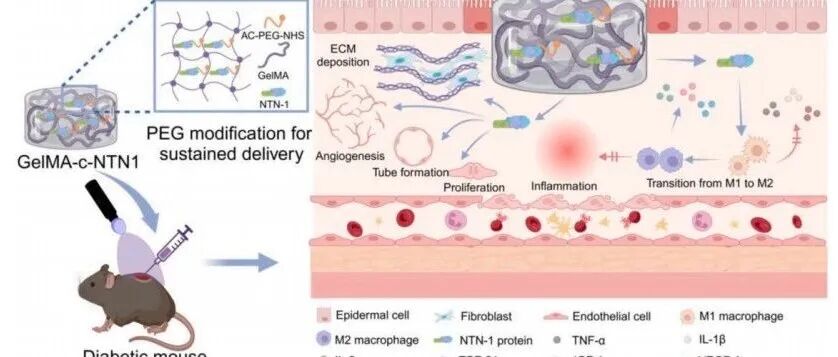 负载Netrin-1的GelMA水凝胶加速糖尿病伤口原位愈合