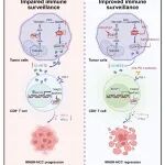 Gut | 重庆医科大学黄爱龙/唐霓/金艾顺团队揭示MASH相关肝癌进展和免疫治疗抵抗的新机制