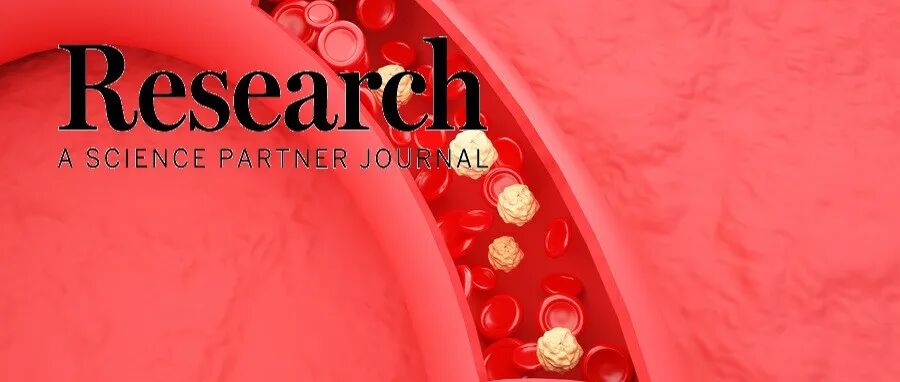 Research | DKK3通过促进血管平滑肌细胞表型转化加速腹主动脉瘤的发展