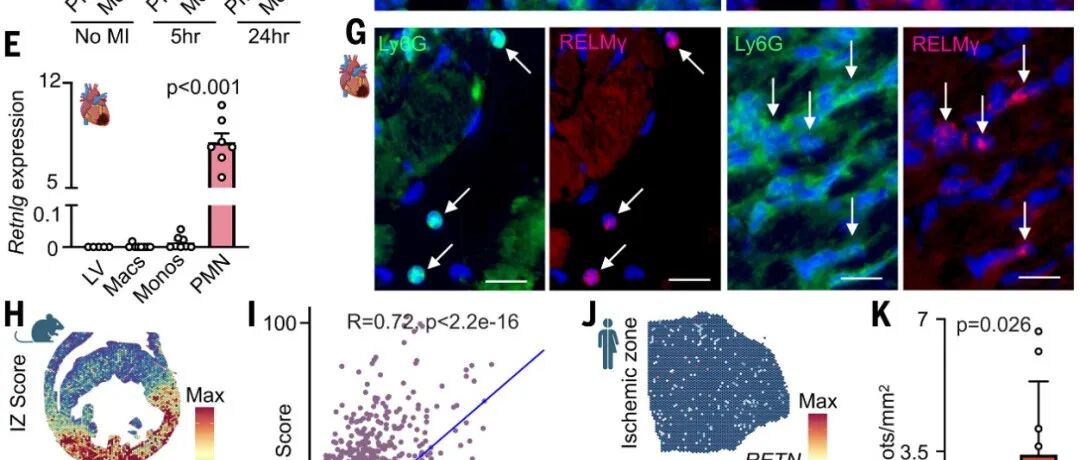 Science | RELMγ通过破坏心肌细胞膜促进心梗后心律失常