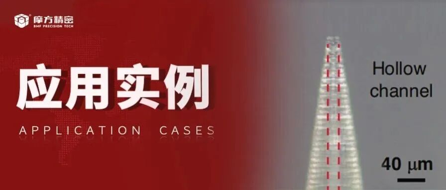 3D打印带刺微针系统，实现伤口实时监测与智能给药一体化
