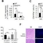 Adv Sci | 北京师范大学刘光伟/毕玉晶发现抑制结直肠癌肠上皮细胞功能的调控新机制