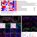 Adv Sci | 中国医学科学院李燕等团队通过空间分辨多组学技术揭示造釉细胞型颅咽管瘤中的代谢重编程与自噬激活