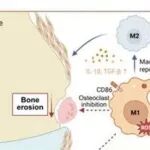 Adv Sci | 同济大学吴鹏等团队开发新的纳米酶，用于类风湿关节炎中关节炎症的靶向抑制及破骨细胞生成的靶向调控