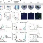 Nature子刊 | 北京大学刘志博/曾泽贤发现硼中子俘获治疗可实现免疫细胞保护，并诱导强效抗肿瘤免疫应答