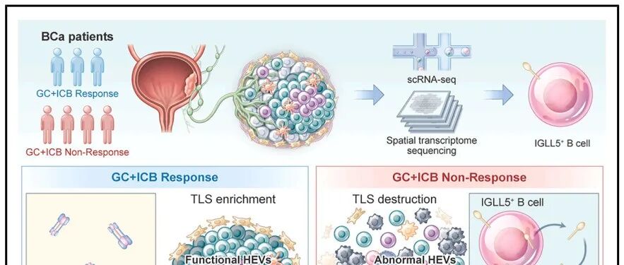 Cancer Cell | 肿瘤内B细胞的“背叛”，中山大学林天歆/陈长昊团队揭示B细胞破坏三级淋巴结构并抑制抗肿瘤免疫