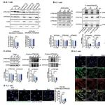 Autophagy | 重庆医科大学研究团队揭示心脏脂质过载背景下V-ATP酶组装的综合方法学评估：对(内)溶酶体功能和自噬的影响