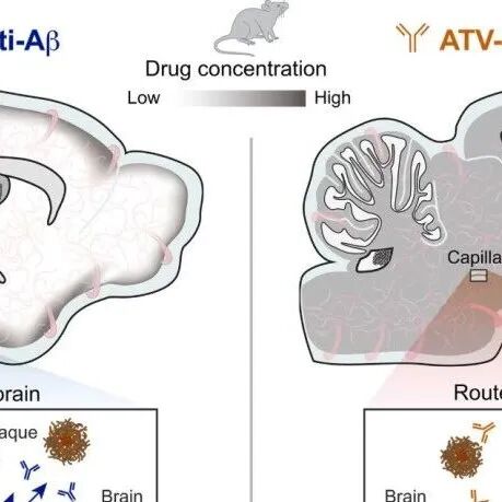 Science | 温州医科大学宋伟宏述评：改善阿尔茨海默病免疫治疗有了新路径